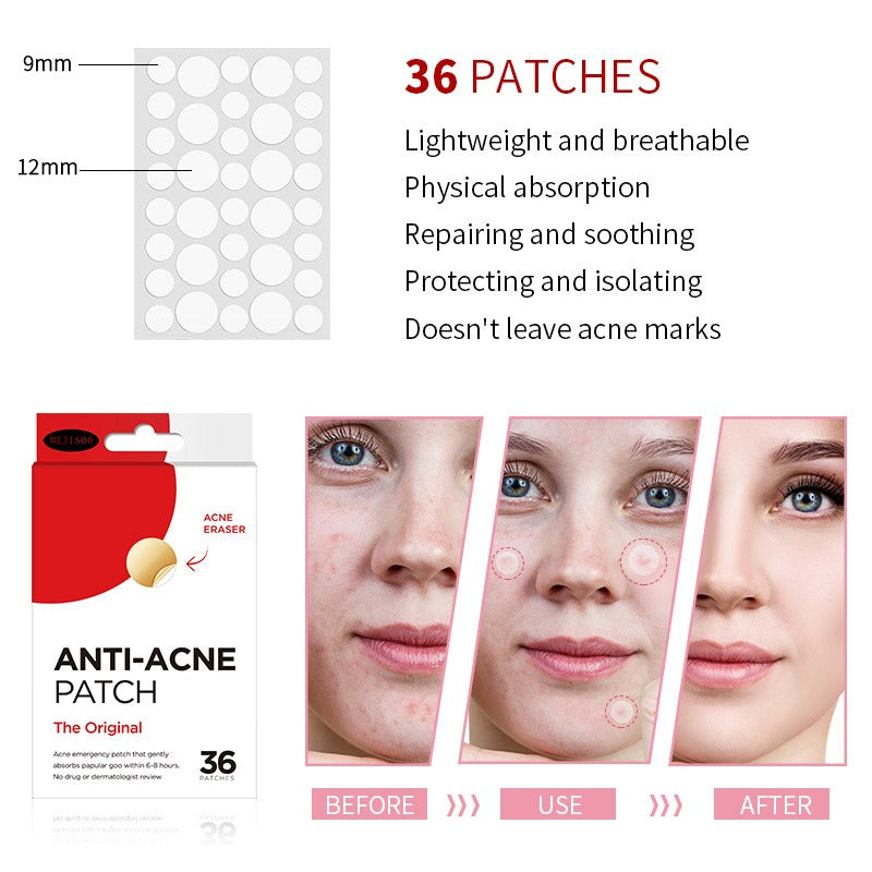 Acne Patch: 36 Invisible Water Gel Capsules for Clear, Confident Skin