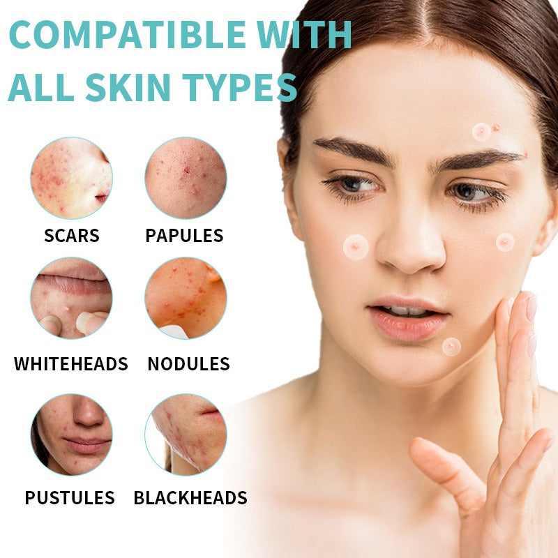 Acne Patch: 36 Invisible Water Gel Capsules for Clear, Confident Skin