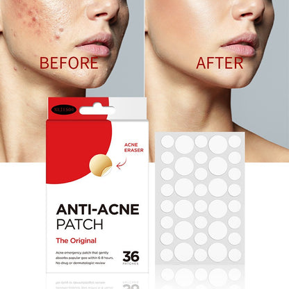 Acne Patch: 36 Invisible Water Gel Capsules for Clear, Confident Skin